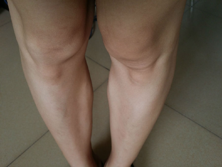 我的雙腿醜陋，有什麼因果，要如何修正？