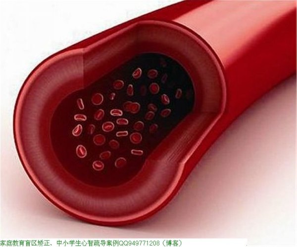 血管是如何一天天堵塞的